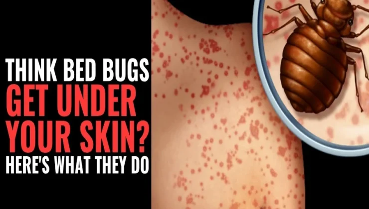 Bed Bugs