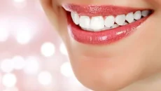 Booking Teeth Whitening